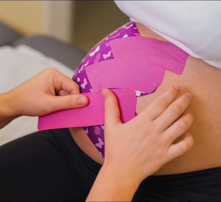 Kinesiotaping w ciąży
